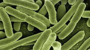 ALERT: Irish cheese product recalled from shops due to presence of harmful bacteria