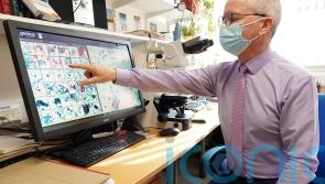 Artificial intelligence tech could improve cervical cancer diagnoses, UK experts say