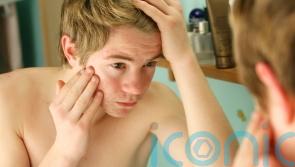 EXPLAINED: How to support a teenager who has acne