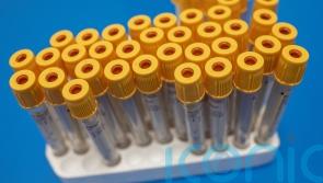 Adult diagnosed with measles dies in Irish hospital