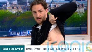 I call it my new little superpower &ndash; Tom Lockyer shows defibrillator scar