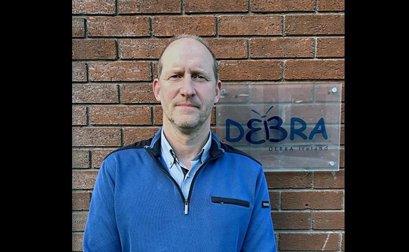 Gel therapy to treat &lsquo;butterfly skin&rsquo; condition welcomed by Irish charity