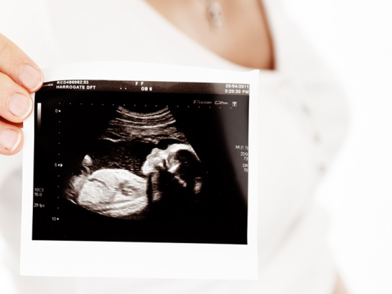 &nbsp;Irish people with infertility can soon avail of public IVF as start date revealed