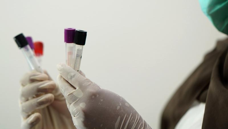 Doctor expresses concern over lack of HPV screening after man dies of genital warts