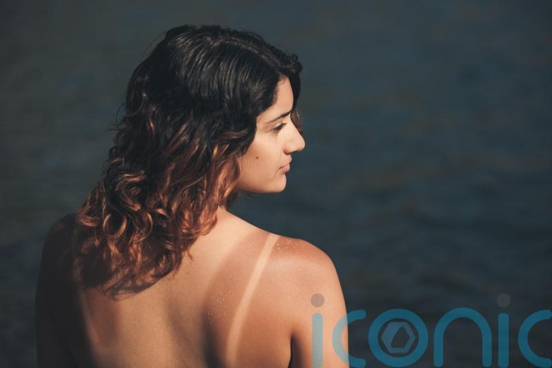 EXPLAINER: 5 sunburn myths we need to stop believing