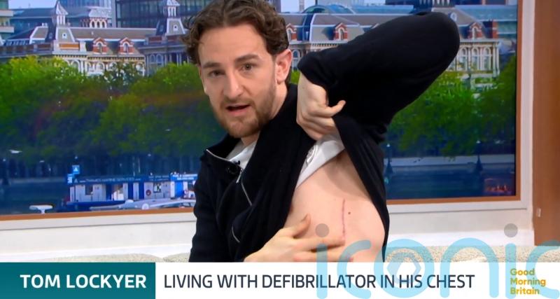 I call it my new little superpower &ndash; Tom Lockyer shows defibrillator scar