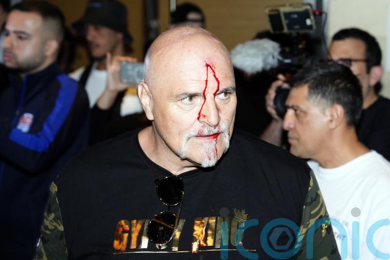 Tyson Fury&rsquo;s father John suffers cut to head as Oleksandr Usyk fight week begins