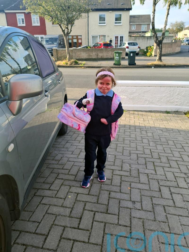 Girl with rare skin disease excited to go to secondary school